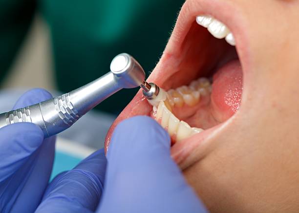 Best Root Canal Treatment  in Garden City, NY